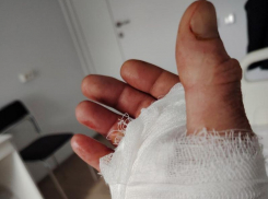 Мэра Энергодара Пухова прооперировали местные врачи 