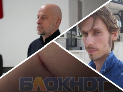 Новости Запорожья: собаки изувечили девушку, предсказание пророка и коррупционный скандал