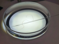 Запорожские врачи достали у женщины из глаза червя после укуса комара