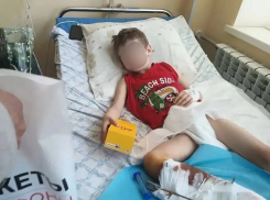 Бездомная собака напала на мальчика в Каменке-Днепровской