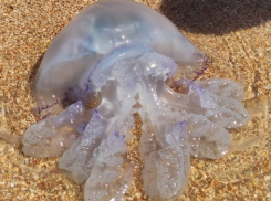 Врач рассказал, как лечить ожог от медузы на Азовском море