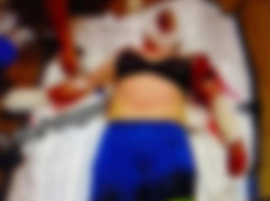 Жительница запорожского села получила жуткие травмы после удара ВСУ по «Жигулям»