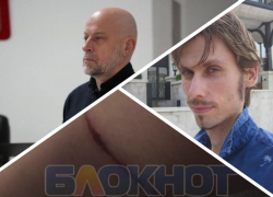 Новости Запорожья: собаки изувечили девушку, предсказание пророка и коррупционный скандал