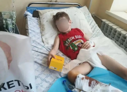 Бездомная собака напала на мальчика в Каменке-Днепровской