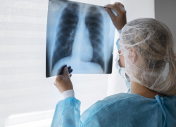 В Запорожскую область доставили новое рентгеноборудование