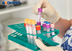 Сообщения о новом вирусе с кровавым кашлем прокомментировал запорожский Роспотребнадзор