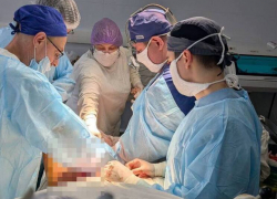 В Запорожской области впервые провели сложную гибридную операцию на сосудах
