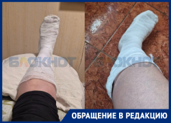 Жёсткую подставу учинил неработающий лифт для женщины с переломом ноги в Днепрорудном 