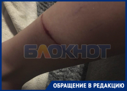 Появилось фото жуткого последствия нападения бездомных псов на жительницу Днепрорудного