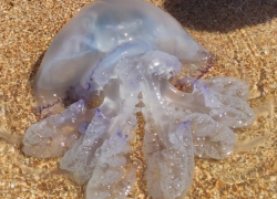 Врач рассказал, как лечить ожог от медузы на Азовском море