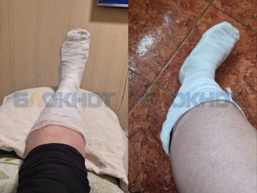 Жительница Днепрорудного вынуждена с переломом ноги подниматься на 5 этаж из-за неработающего лифта