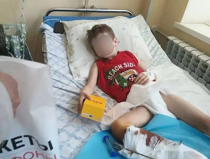 Бездомная собака напала на мальчика в Каменке-Днепровской