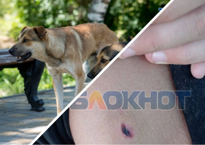 Жительница Мелитополя раскрыла подробности нападения бродячей собаки на 11-летнего сына